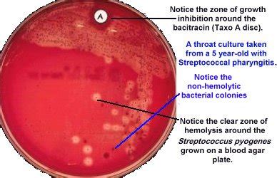 beta strep gp a culture|Throat Culture (Routine) .